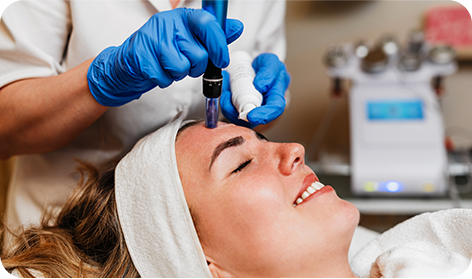 A skincare professional wearing blue gloves performs a microneedling treatment on a woman lying comfortably with a headband.